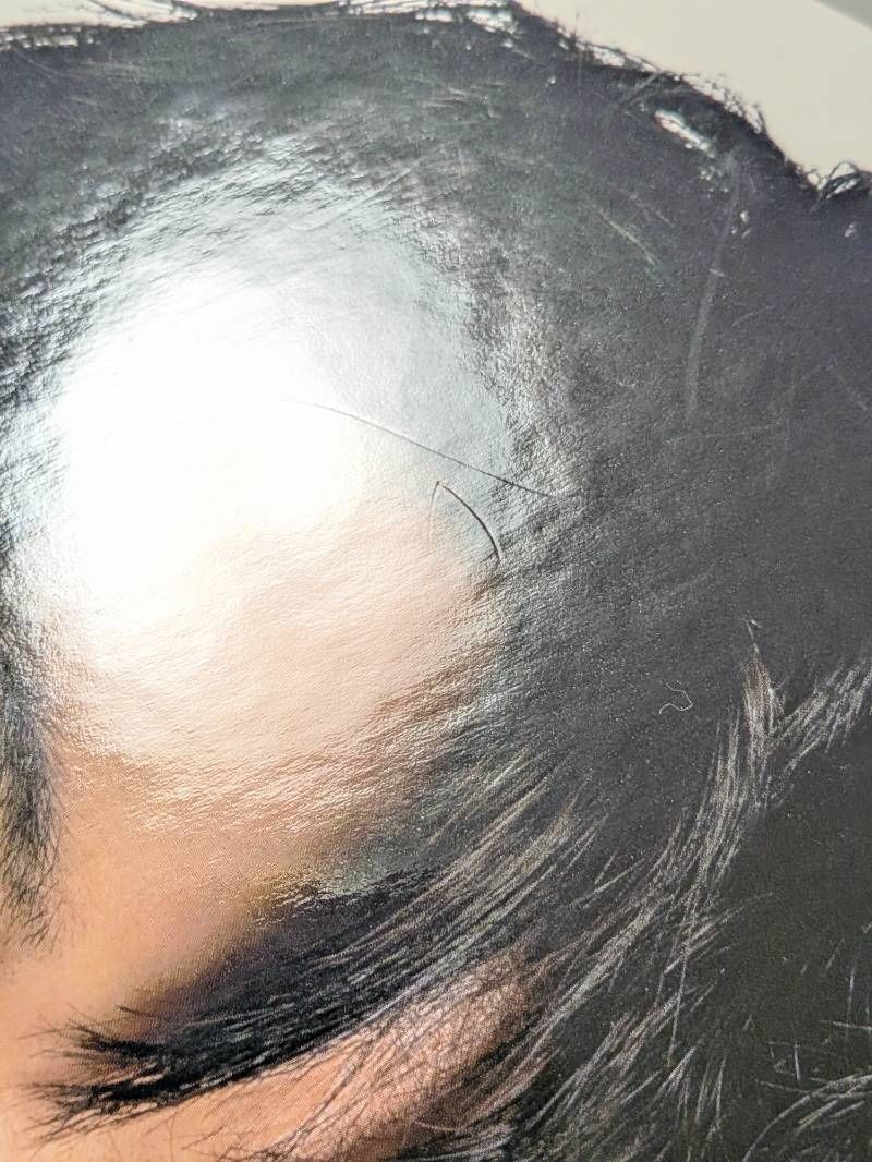 ACEes 美 少年 那須雄登 フォトハンガー 2点セット 第1弾 2019/21夏 未