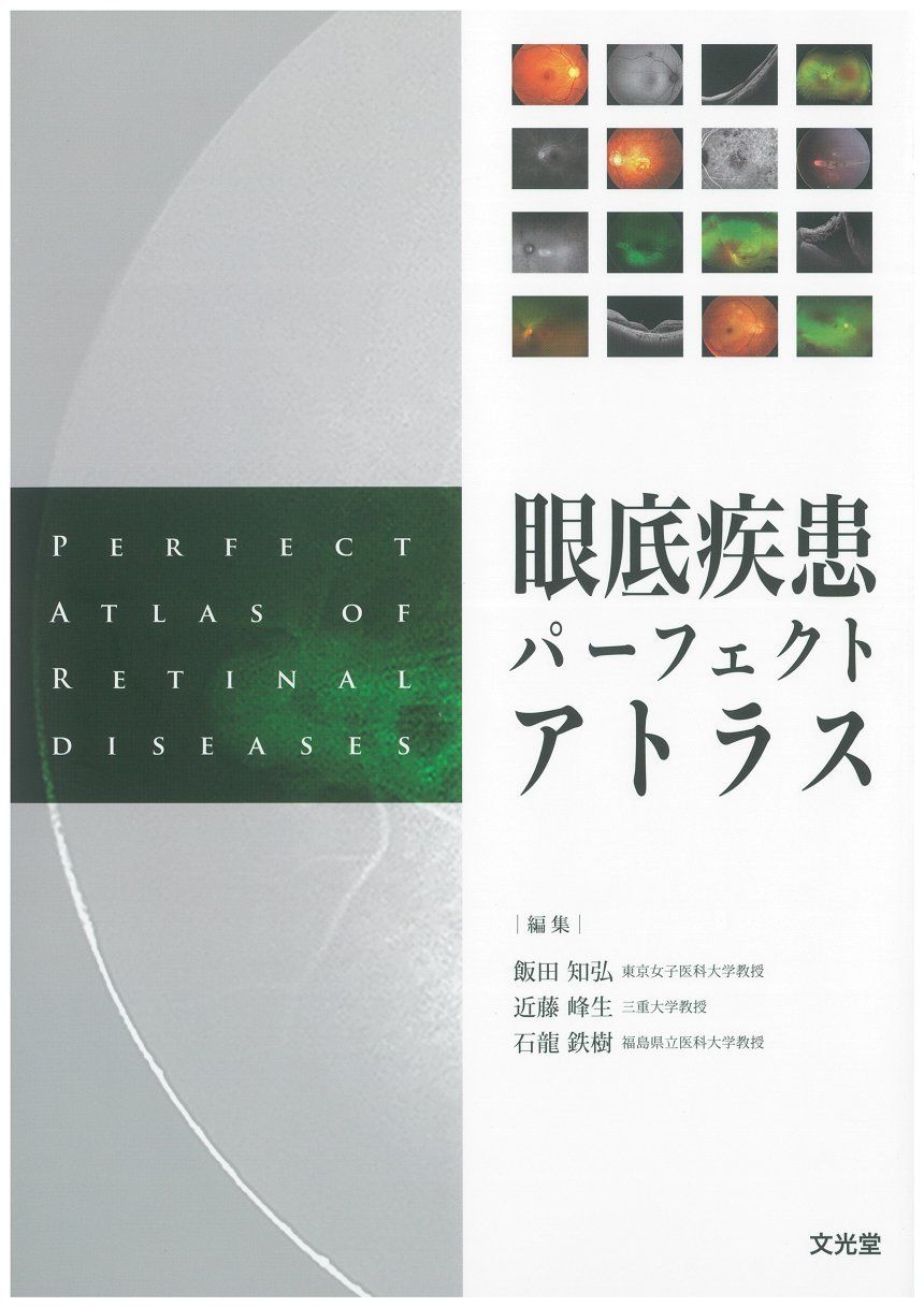 眼底疾患パーフェクトアトラス - メルカリ