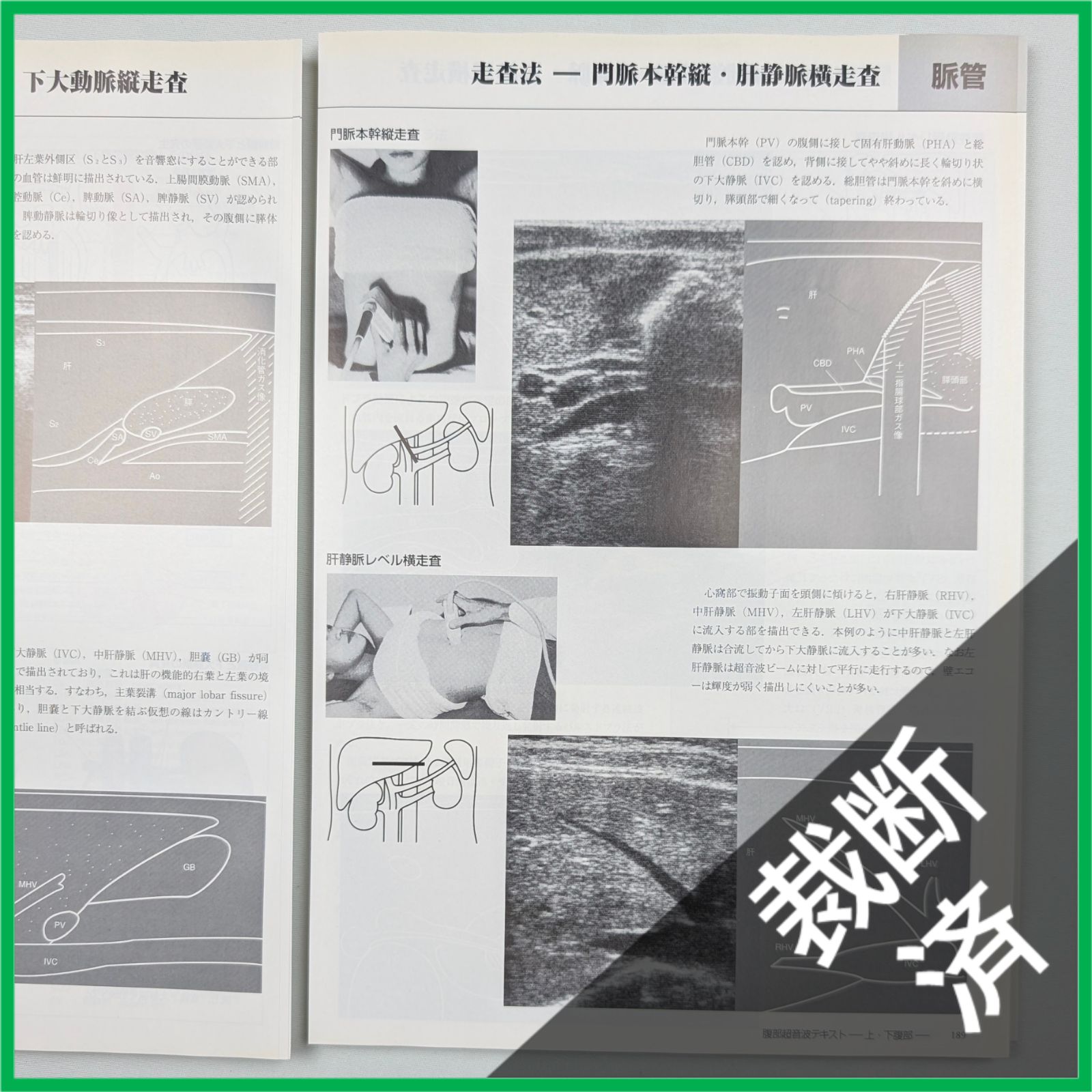 裁断済】 腹部超音波テキスト 上・下腹部 改訂第三版 (Atlas Series超