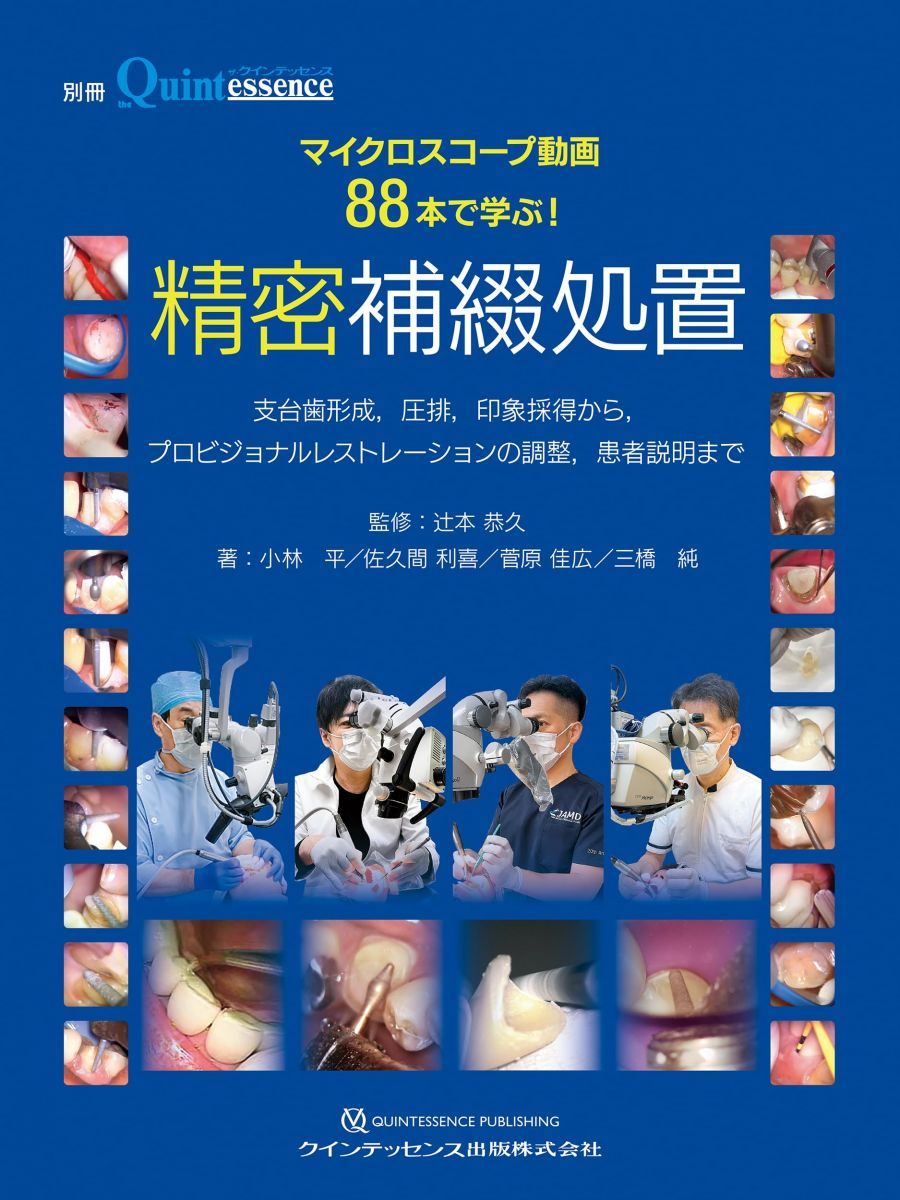 本 【裁断済み】VISUAL支台歯形成・プロビジョナル・レスト