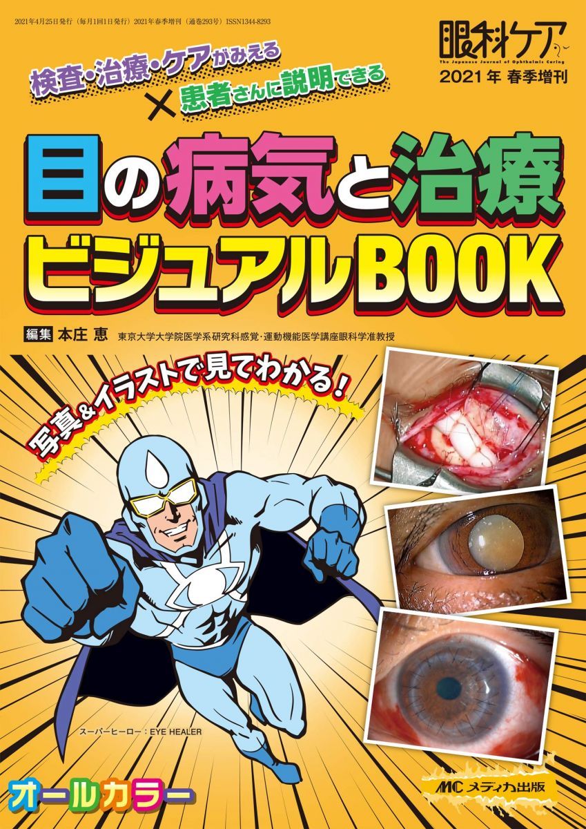 目の病気と治療 ビジュアルBOOK: 検査・治療・ケアがみえる×患者さんに説明できる (眼科ケア2021年春季増刊)