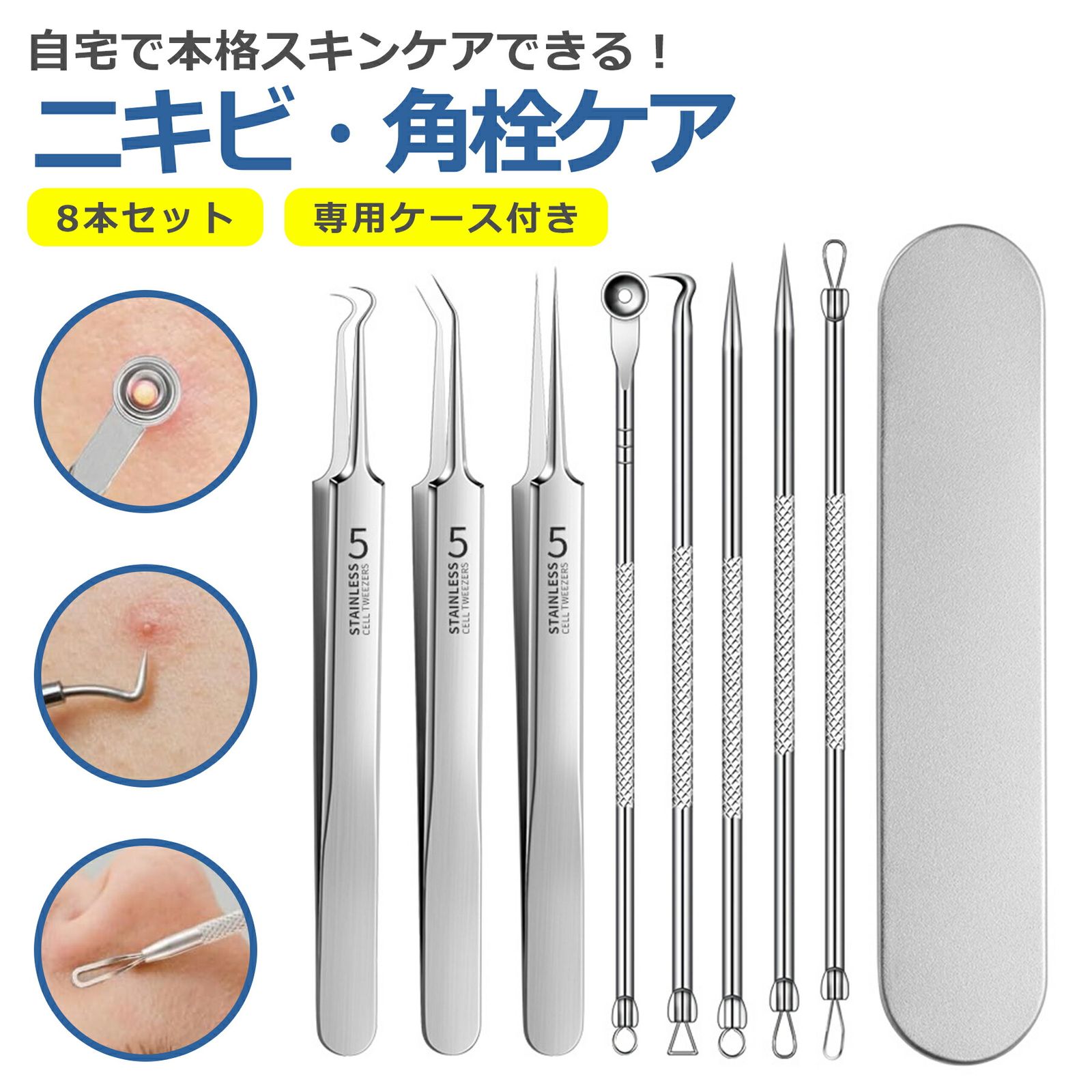 角栓 角栓取り ピンセット 8本セット ステンレス製 精密 毛穴 ケア