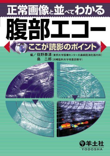 正常画像と並べてわかる腹部エコー―ここが読影のポイント