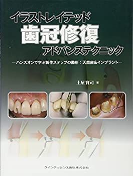 【中古-非常に良い】 イラストレイテッド 歯冠修復 アドバンステクニック (イラストレイテッドシリーズ)