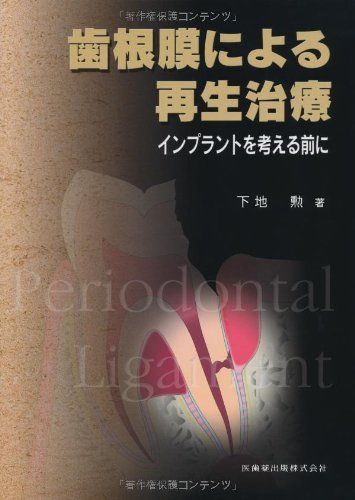 歯根膜による再生治療インプラントを考える前に | UN-BRIN-DE-BEAUTE.FR