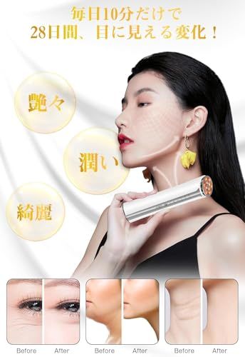 EMS・RF美顔器・美容器 美顔器 【2025新モデル】 EMS美容器 RF美顔器 EMS微電流 4色LED 光