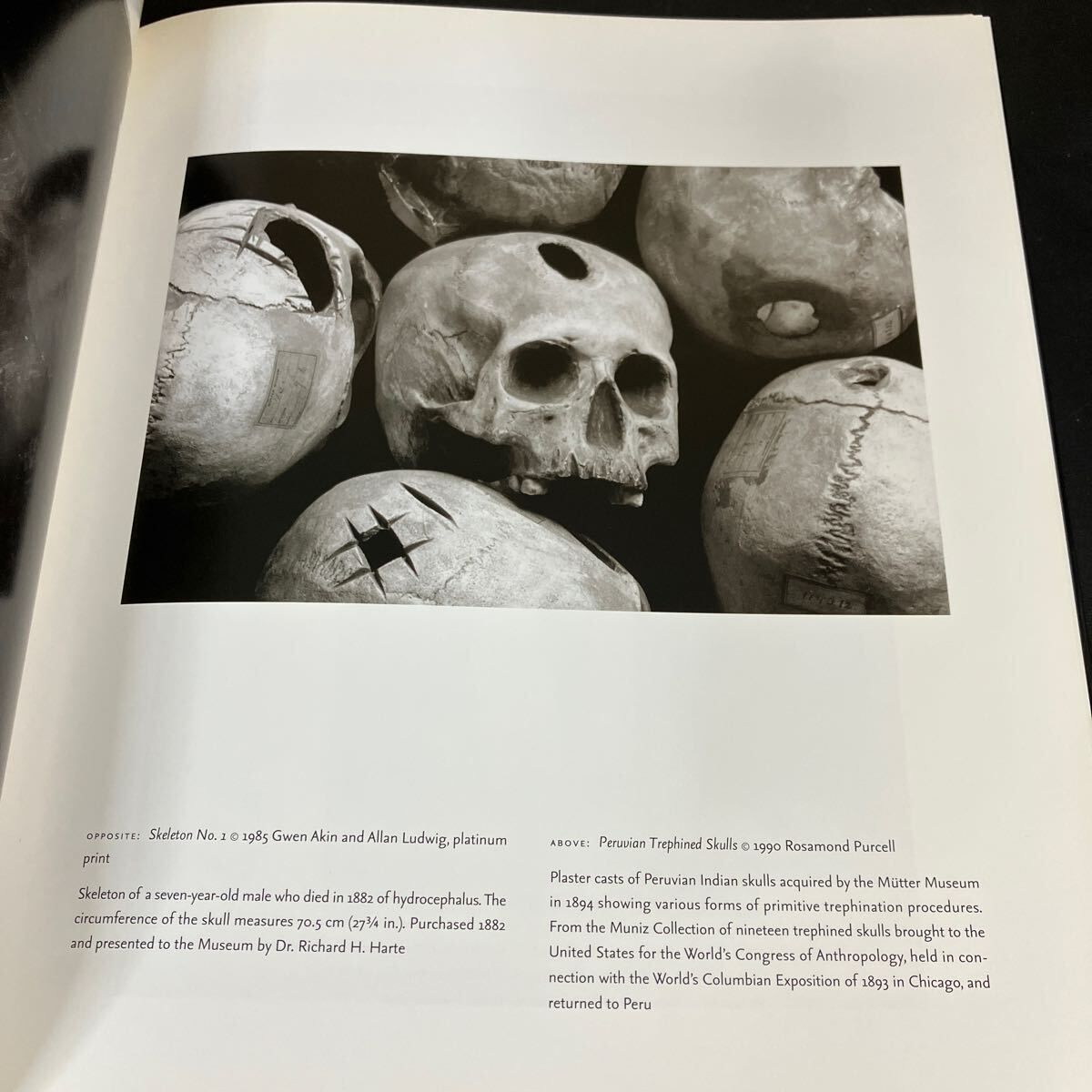 ムター博物館 洋書写真集『 Mutter Museum Historic Medical 