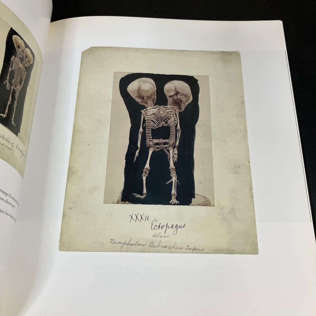 ムター博物館 洋書写真集『 Mutter Museum Historic Medical 