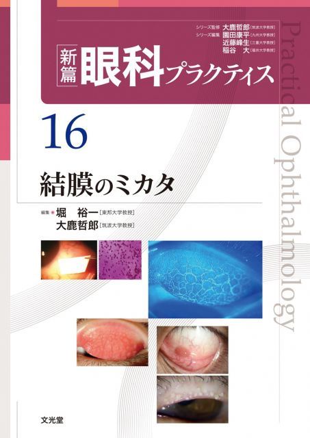 【】結膜のミカタ　(新篇眼科プラクティス 16)
