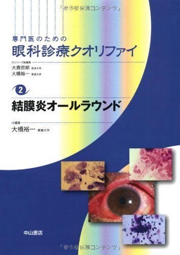 本 【】結膜炎オールラウンド (専門医のための眼科診療クオリファイ)