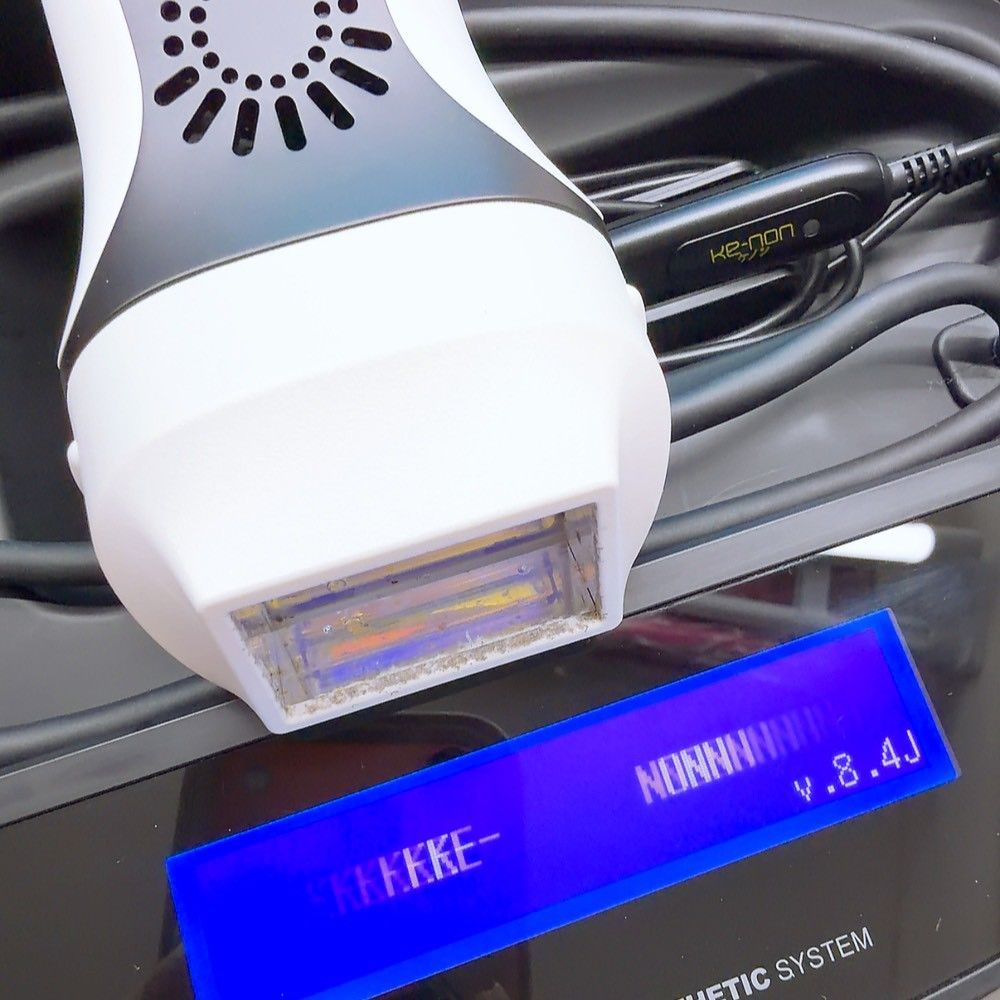 ケノン 脱毛器 v 8.4J KENON家庭用脱毛器 ver8.4 楽天市場】ケノン