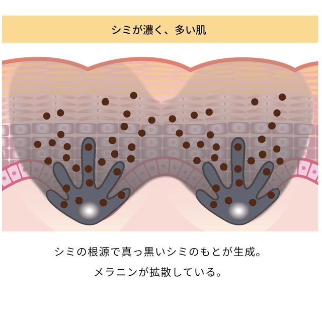 お徳用セット】メラノショット P 本体40ml + 付けかえ用 65ml ワンバイ