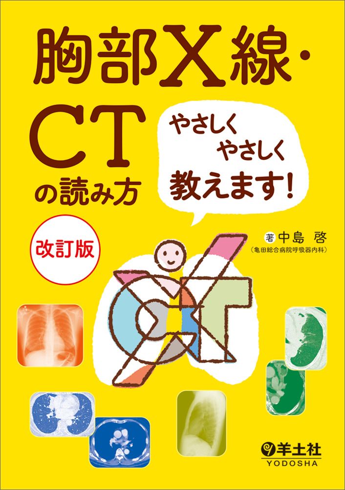 【裁断済み】胸部のCT第4版 胸部のCT 第4版 | 村田喜代史, 上甲 剛, 村山貞之, 酒井文和 |本