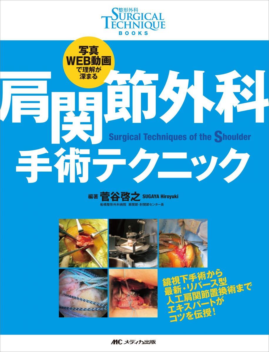 肩関節外科 手術テクニック: 写真・WEB動画で理解が深まる (整形外科SURGICAL TECHNIQUE BOOKS)
