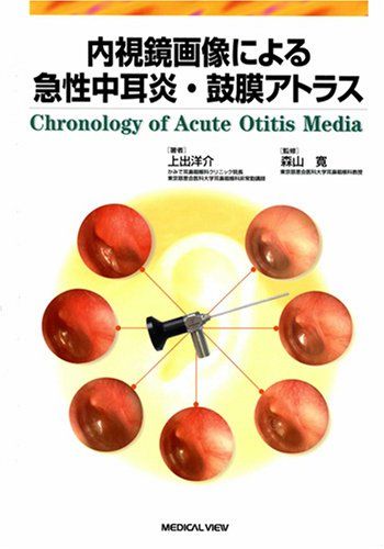 内視鏡画像による急性中耳炎・鼓膜アトラス