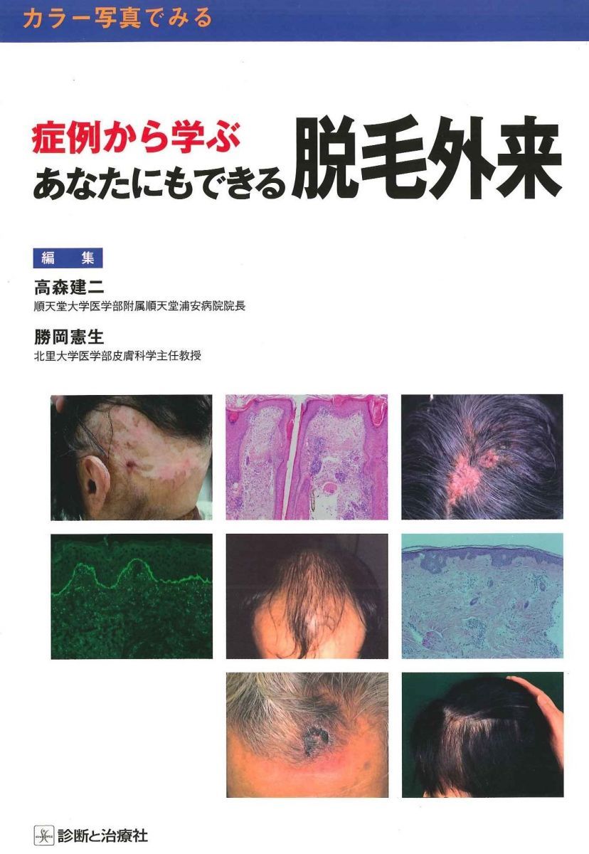 症例から学ぶあなたにもできる脱毛外来