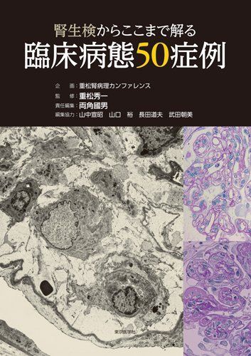 腎生検からここまで解る臨床病態50症例