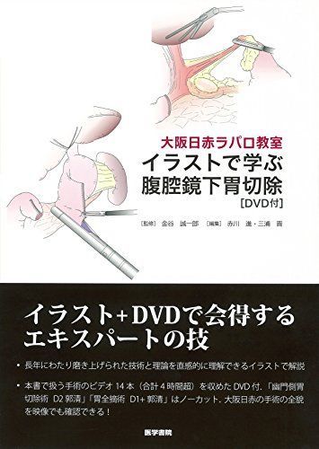 大阪日赤ラパロ教室 イラストで学ぶ腹腔鏡下胃切除[DVD付]