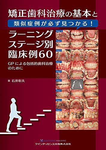 矯正歯科治療の基本と類似症例が必ず見つかる! ラーニングステージ別臨床例60
