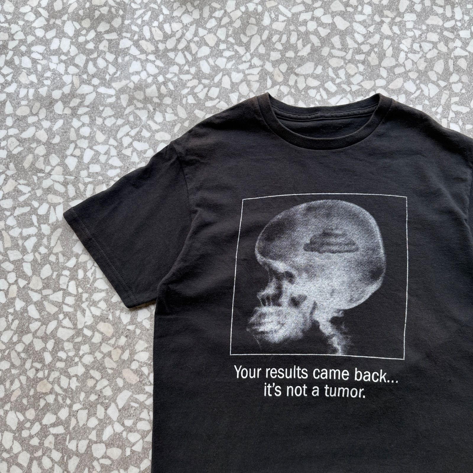 Unknown / X-ray graphic T-shirt sizeS-M相当 X線　レントゲン　グラフィックTシャツ　頭蓋骨　ユニセックス