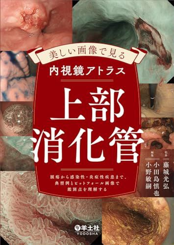 美しい画像で見る内視鏡アトラス　上部消化管?腫瘍から感染性・炎症性疾患まで、典型例とピットフォール画像で鑑別点を理解する