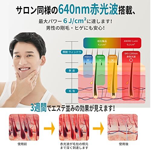 AMIRO 光美容器 脱毛器 最高峰パワー6J/cm? 男性剛毛・ヒゲ対応 640nm赤光波搭載 無制限回数 冷感無痛 フラッシュ式 IPL光脱毛器 メンズ レディース 顔と全身用 家庭用 軽量 日本語説明書付koe 3d40868b AMIRO 光美容器 脱毛器 最高峰パワー6J/cm? 男性剛毛・ヒゲ対応 640nm赤光波搭載 無制限回数 冷感無痛 フラッシュ式 IPL光脱毛器 メンズ レディース 顔と全身用 家庭用 軽量 日本語説明書付koe 3d40868b