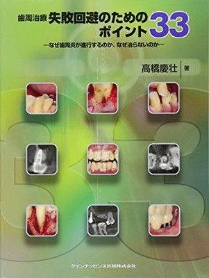 歯周治療 失敗回避のためのポイント33