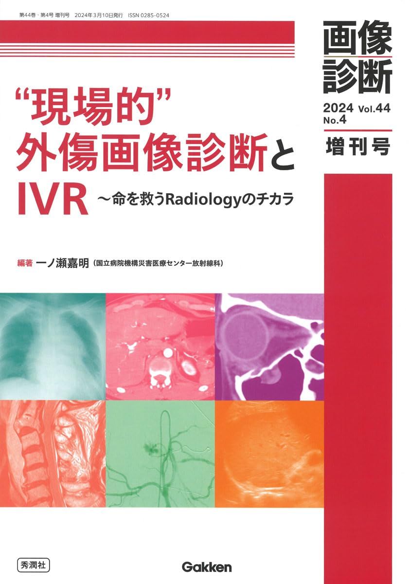 画像診断2024年増刊号Vol.44 No.4: “現場的“外傷画像診断とIVR−命を救うRadiologyのチカラ (画像診断増刊号 2024(Vol.44 No.4))