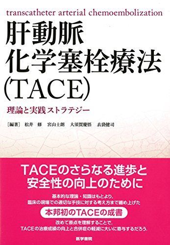 肝動脈化学塞栓療法(TACE): 理論と実践ストラテジー