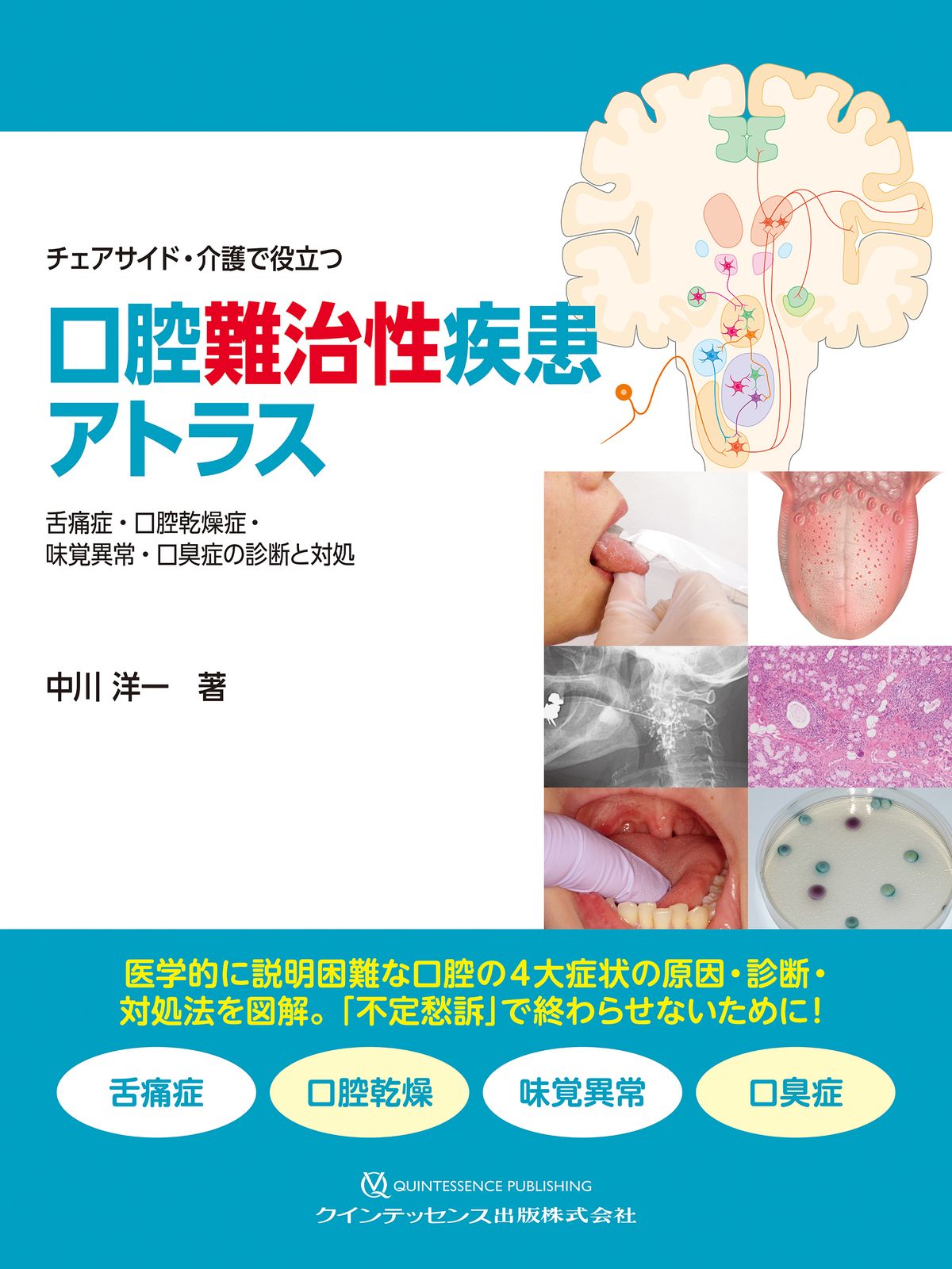 チェアサイド・介護で役立つ 口腔難治性疾患アトラス（大型本）
