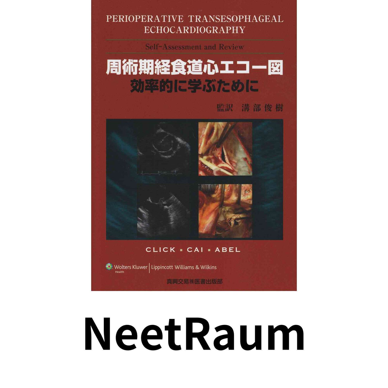 周術期経食道心エコ-図: 効率的に学ぶために ロジャ-・L.クリック? ジョイ・X.ケイ; マ-ティン・D.アベル
