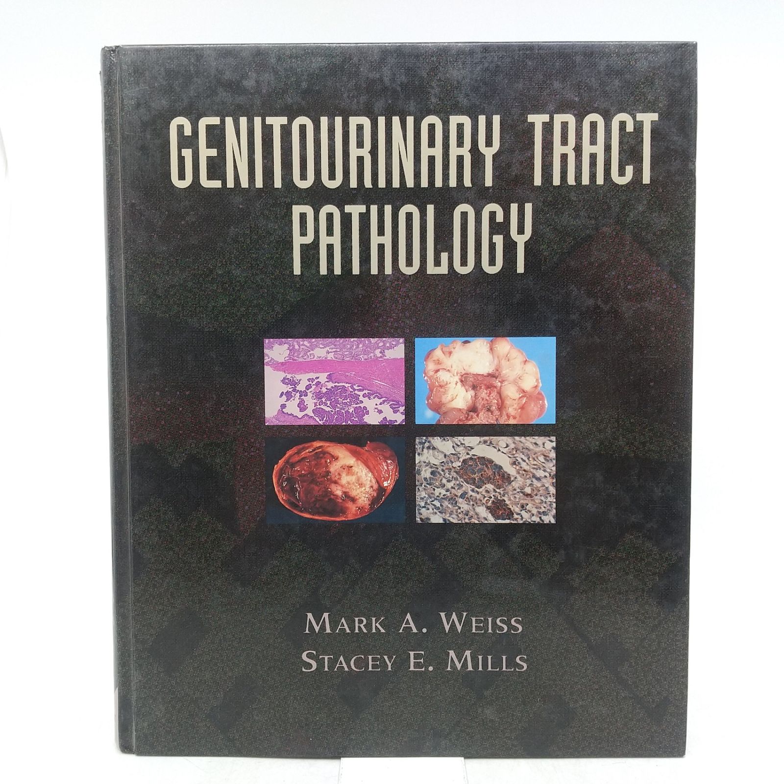 【洋書】Genitourinary tract pathology Mark A. Weiss Stacey E. Mills 医学書 1993年(平成5年)発行 2605LXth28