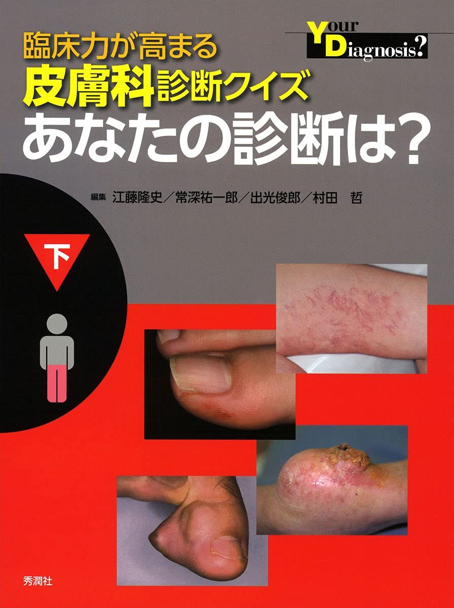 臨床力が高まる皮膚科診断クイズ 下