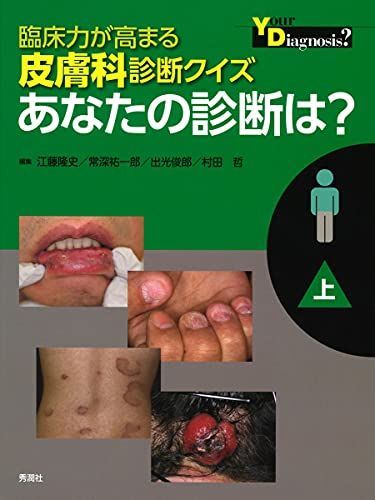 臨床力が高まる皮膚科診断クイズ　上