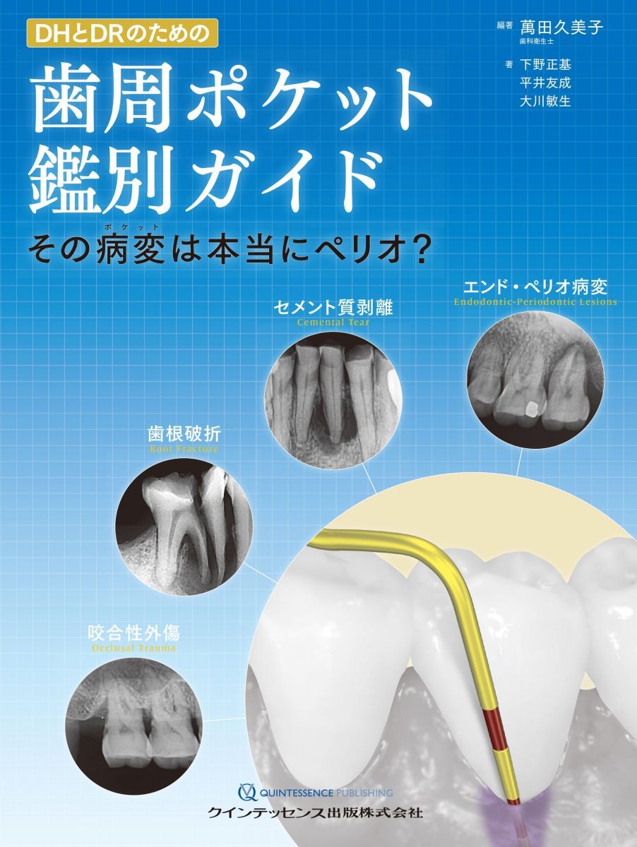 DHとDRのための歯周ポケット鑑別ガイド