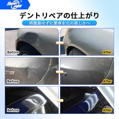 Super PDR デントリペアツールセット PDR用 車の凹み修理工具セット デントリペア 工具 凹み修復工具 自動車鈑金 塗装不要 デントリフター スライドハンマー 引っ張り工具 収納バッグ付きso dc272e79