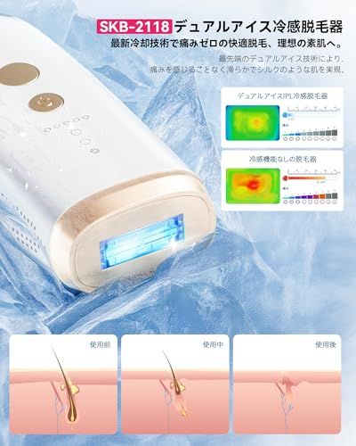 YUNDOO 脱毛器 サロン級冷感無痛 【2025革新的連射冷却アイス 痛感ゼロ IPL光脱毛】VIO対応 美肌モード レディース メンズ 光脱毛器 99万回照射 5段階調節 高出力 デュアルアイス冷却脱毛 顔 髭 脇 腕 足用 全身ムダ毛ケ ae1290b8