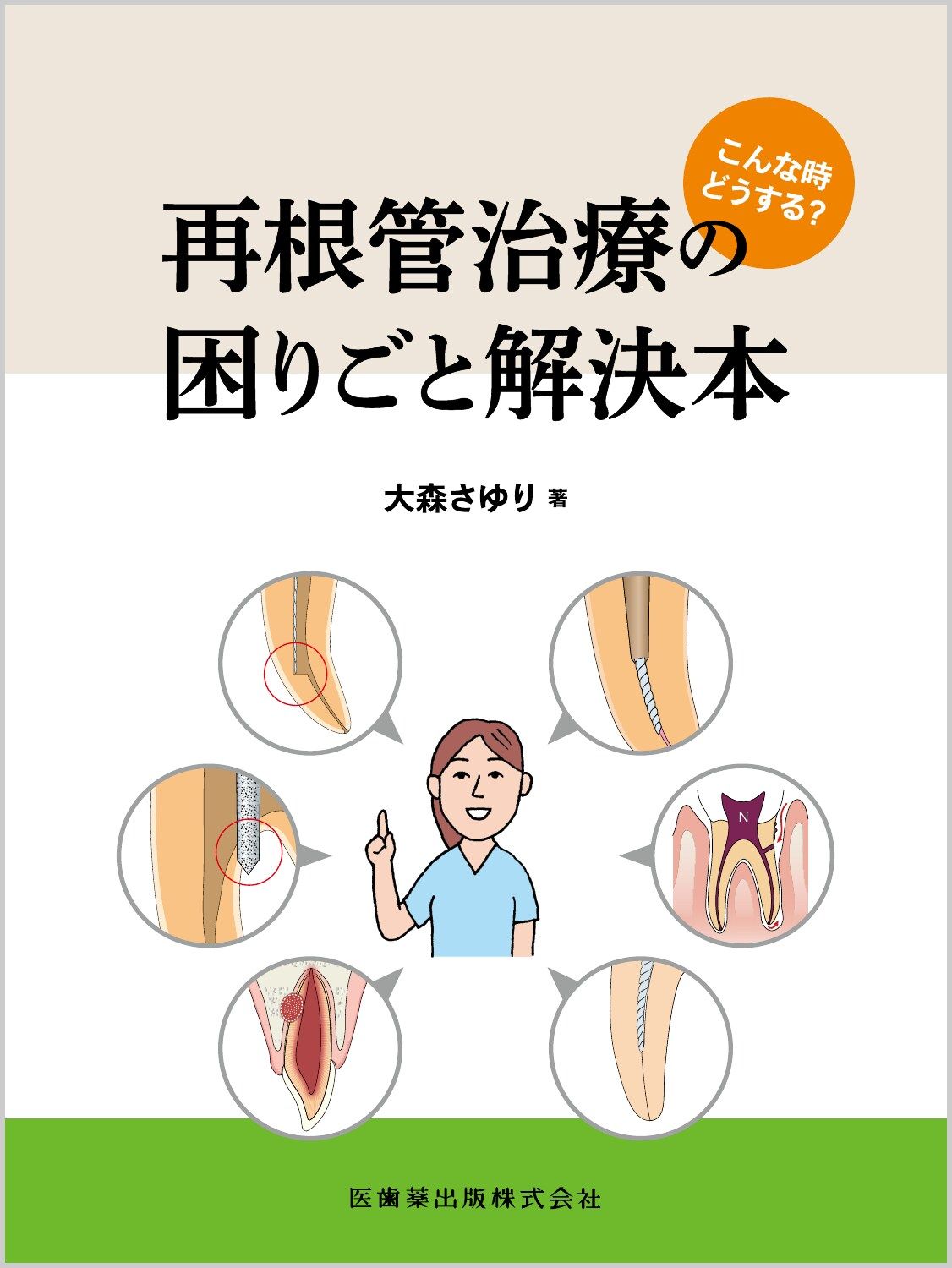 こんな時どうする？ 再根管治療の困りごと解決本（大型本）