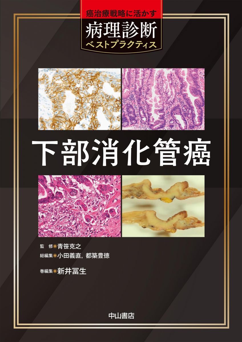 下部消化管癌<癌治療戦略に活かす病理診断ベストプラクティス>