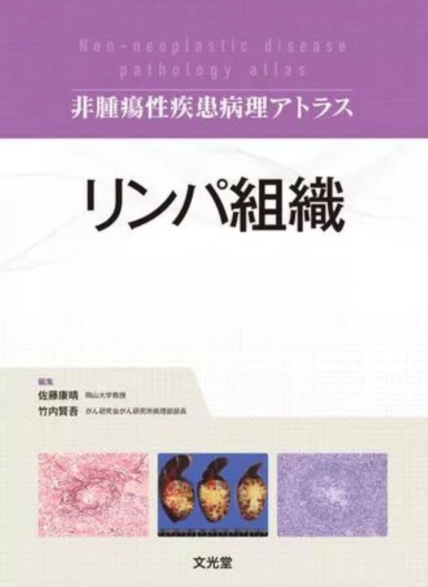 リンパ組織 (非腫瘍性疾患病理アトラス)