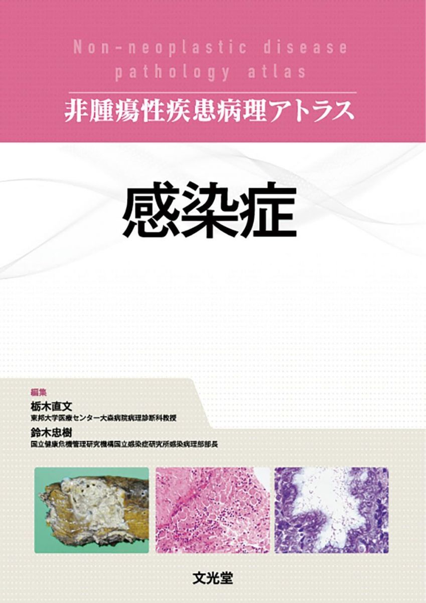 感染症 (非腫瘍性疾患病理アトラス)