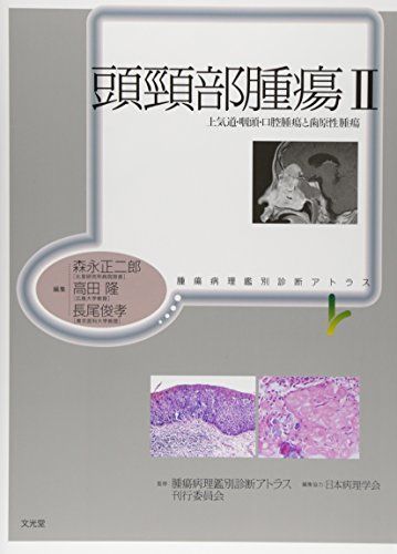 頭頚部腫瘍 (2) (腫瘍病理鑑別診断アトラス)