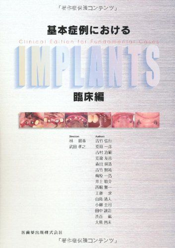 基本症例におけるIMPLANTS 臨床編