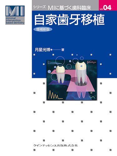 自家歯牙移植 増補新版 (シリーズ MIに基づく歯科臨床)