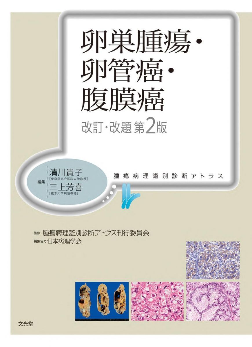 卵巣腫瘍・卵管癌・腹膜癌 改訂・改題第2版(腫瘍病理鑑別診断アトラス)