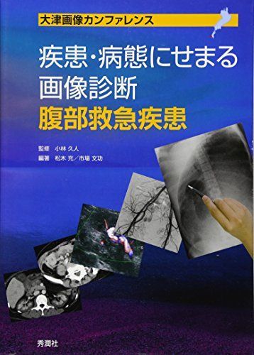 疾患・病態にせまる画像診断 腹部救急疾患 (大津画像カンファレンス)