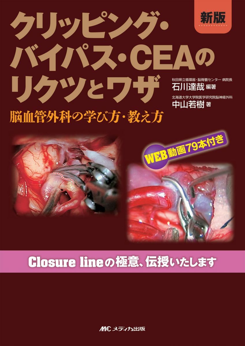 新版 クリッピング・バイパス・CEAのリクツとワザ: 脳血管外科の学び方・教え方/WEB動画79本付き 10,692円