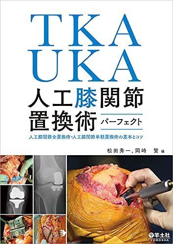 TKA・UKA 人工膝関節置換術パーフェクト-人工膝関節全置換術・人工膝関節単顆置換術の基本とコツ