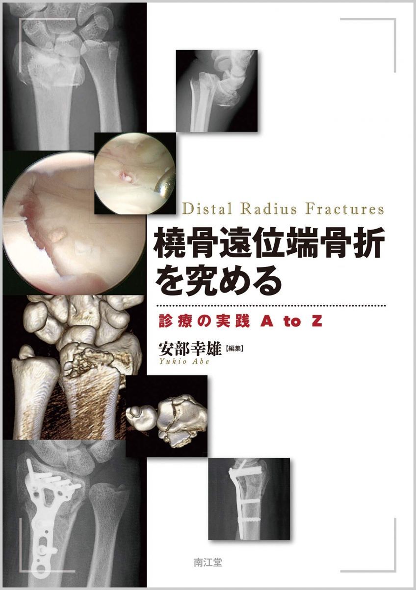 橈骨遠位端骨折を究める: 診療の実践 A to Z