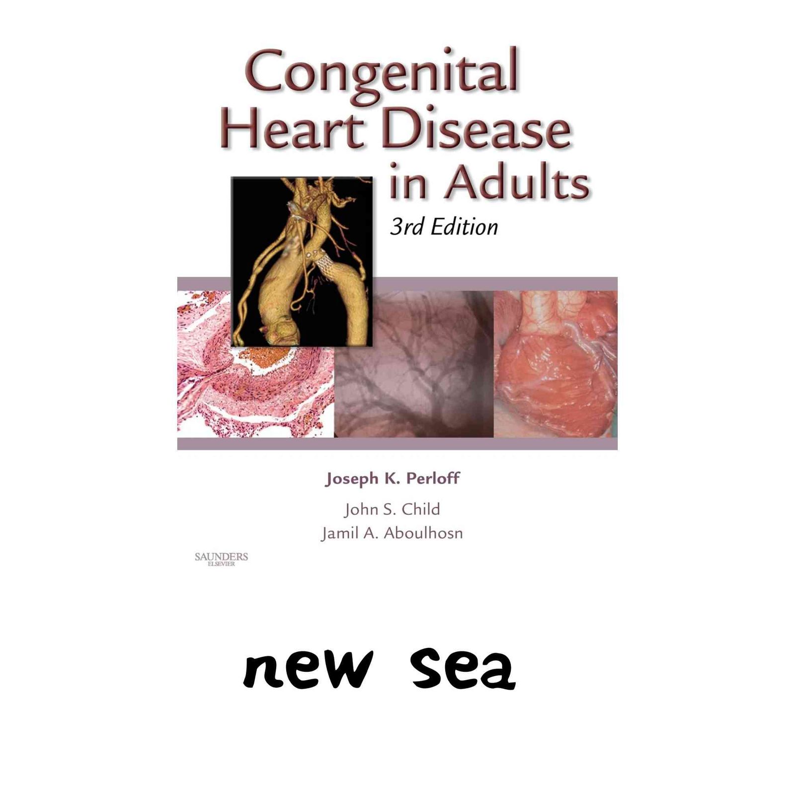 Congenital Heart Disease in Adults [ハードカバー] Perloff MD, Joseph K.? Child MD FACC, John S.; Aboulhosn, Jamil